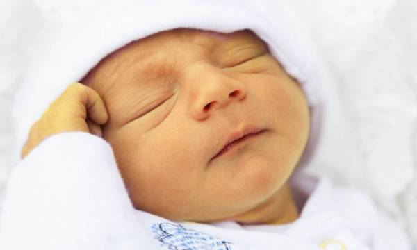 مشاهده علائم و روش های درمان زردی نوزاد