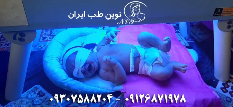 دستگاه زردی
